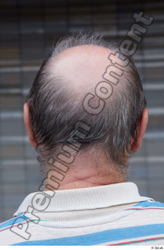 Head Hair Man White Casual Average Bald Street photo references